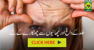 Jild K Dagh Or Chaion Se Chutkare K Liye | Totkay